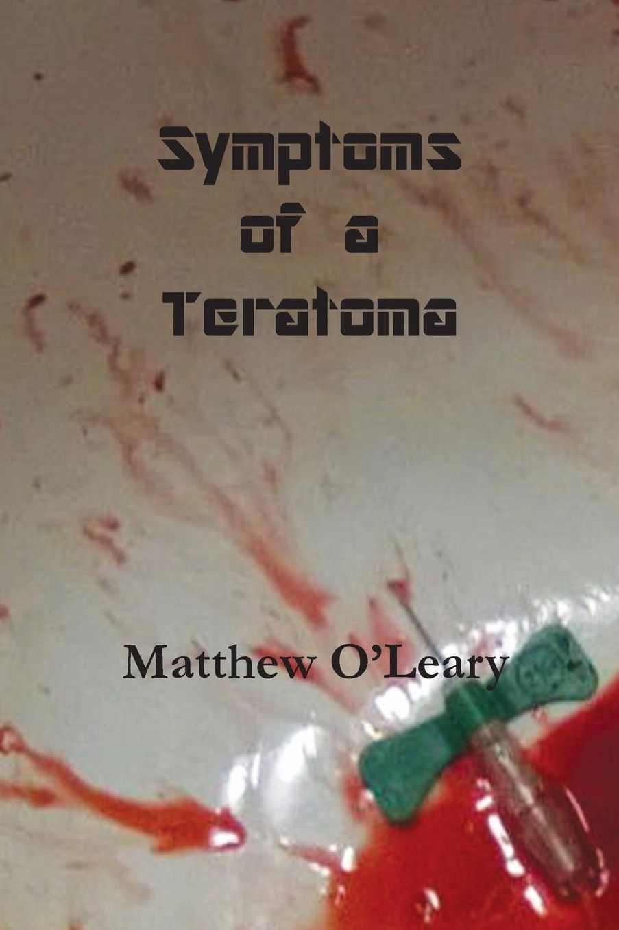 Symptoms of a Teratoma