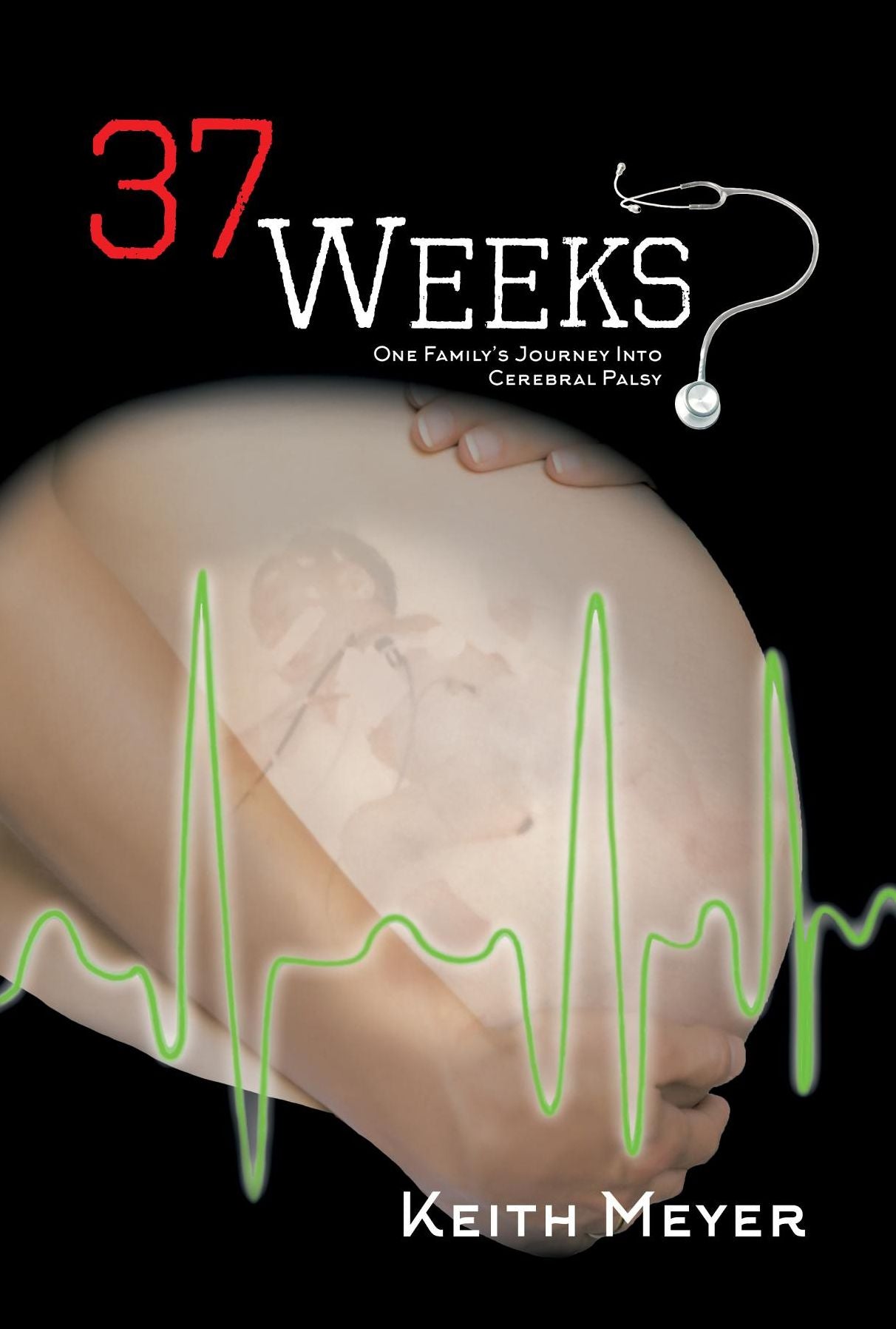 37 Weeks: One Family's Journey Into Cerebral Palsy