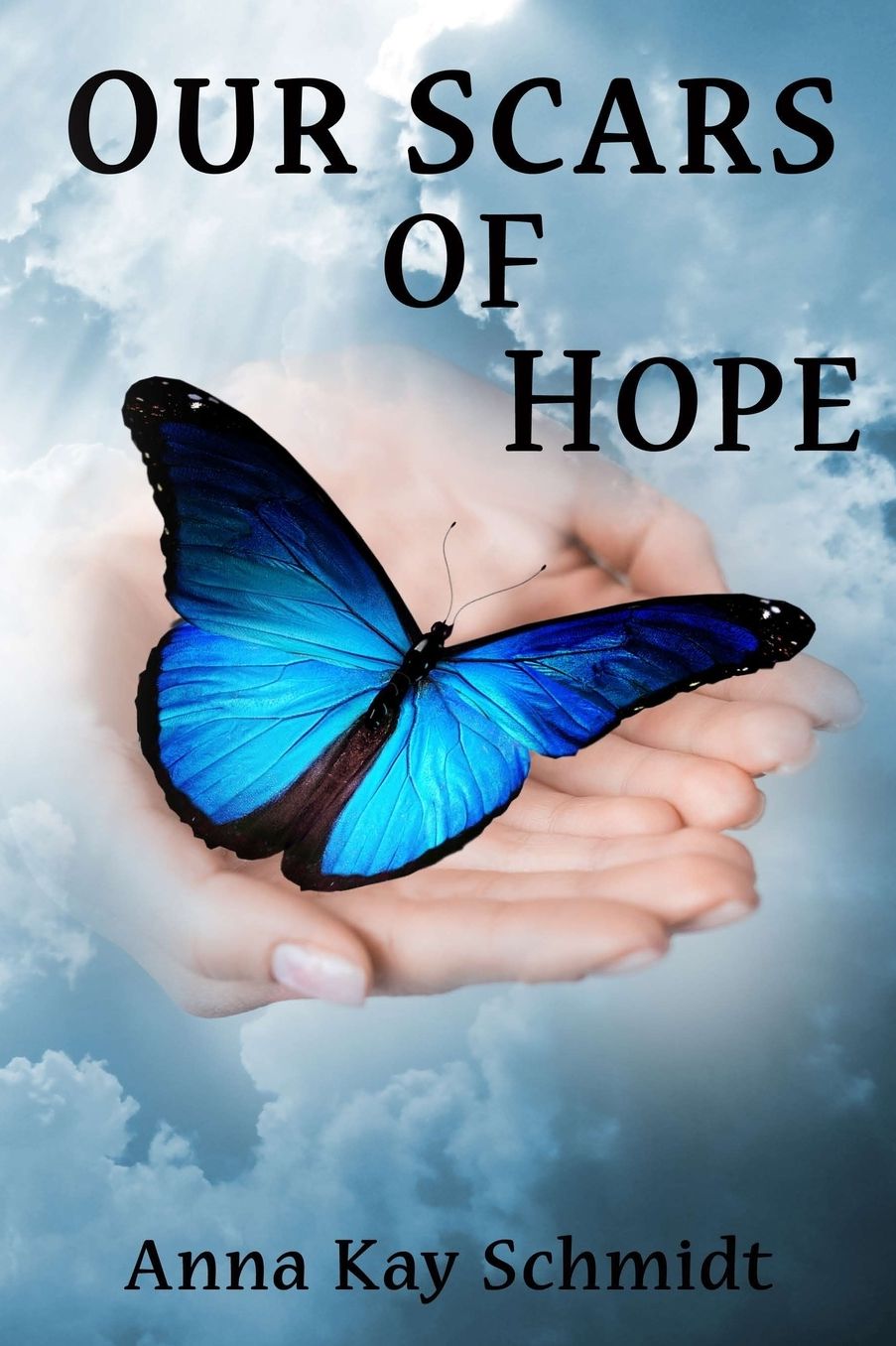 Our Scars of Hope