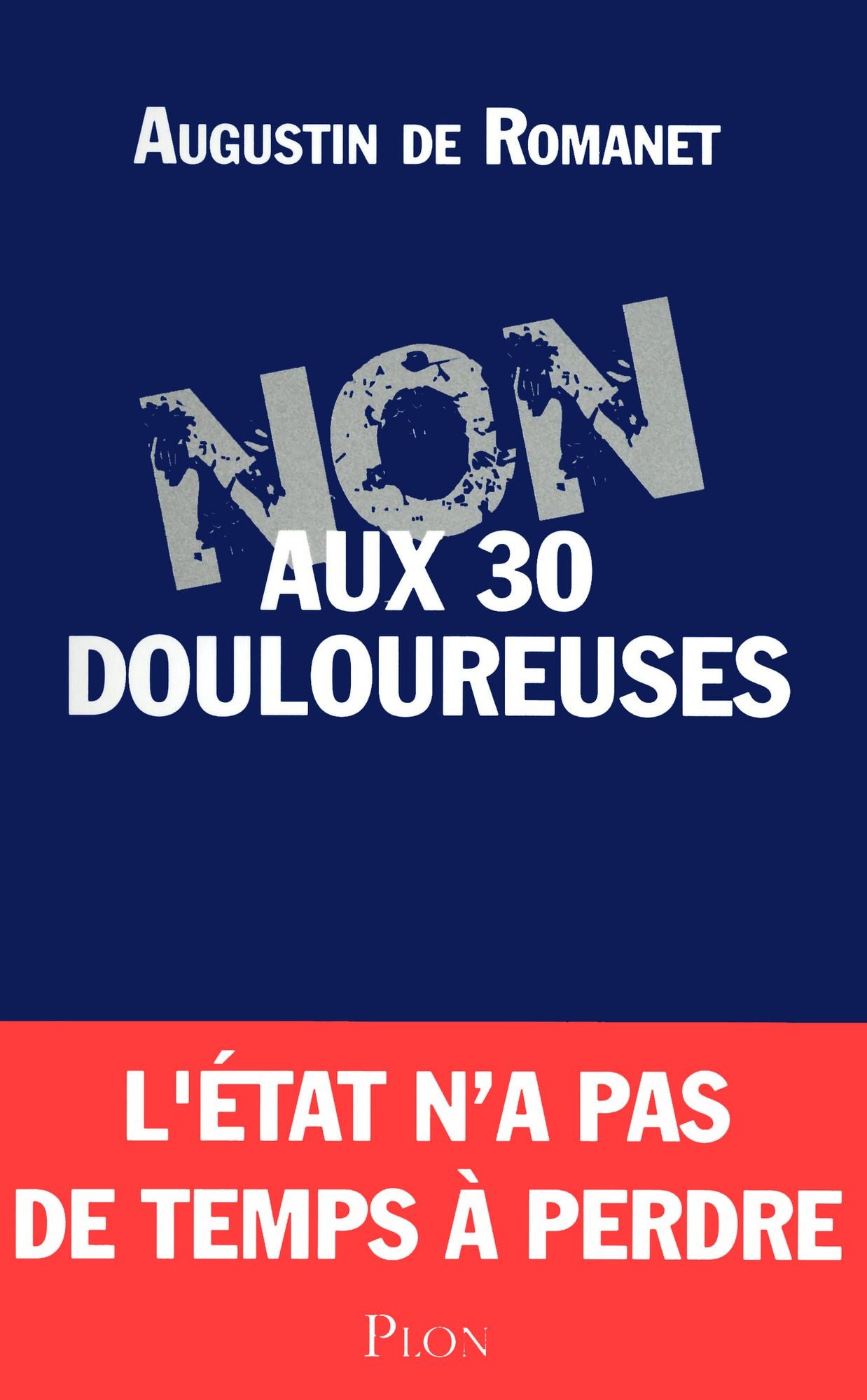 Non aux 30 douloureuses