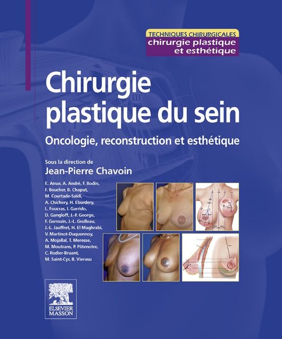 Chirurgie plastique du sein: Application mobile