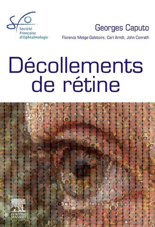 Décollements de rétine: Rapport SFO 2011