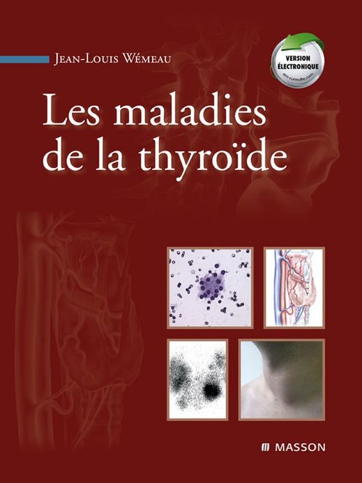 Les maladies de la thyroïde