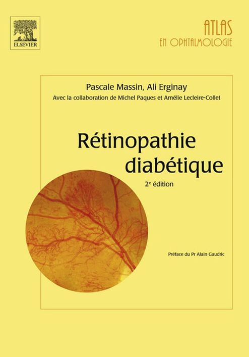 Rétinopathie diabétique