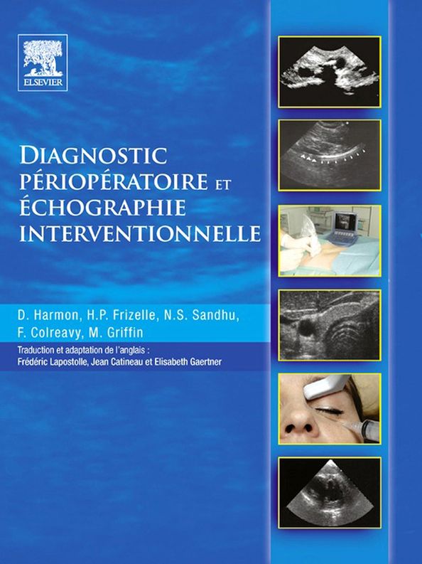 Diagnostic périopératoire et échographie interventionnelle: avec DVD en anglais