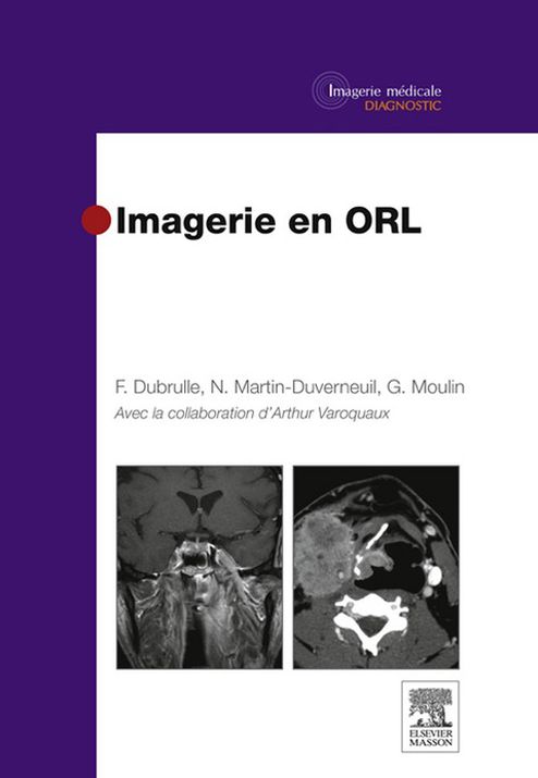 Imagerie en ORL