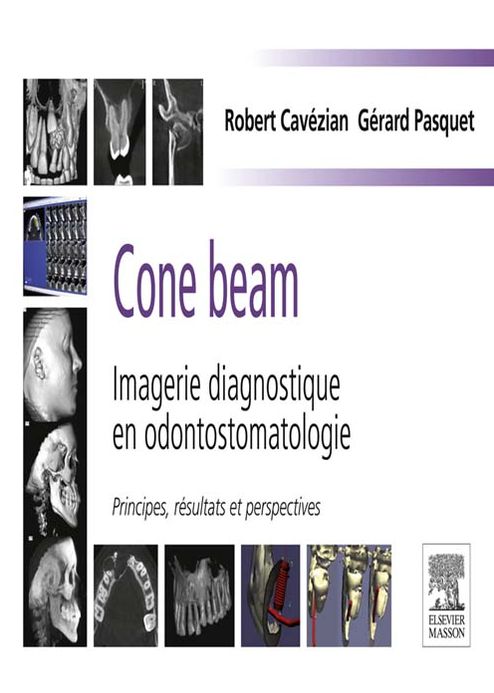 Cone beam : Imagerie diagnostique en odontostomatologie: Principes, résultats et perspectives