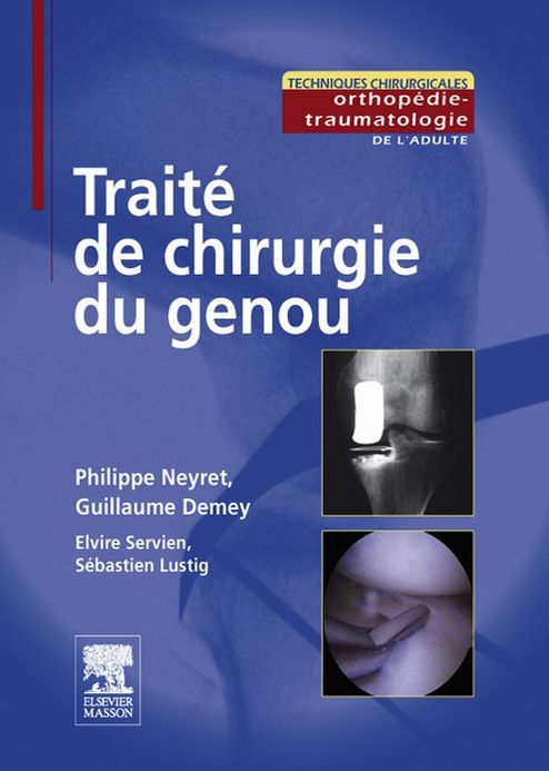 Traité de chirurgie du genou