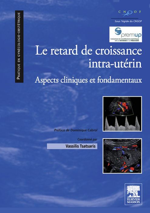 Le retard de croissance intra-utérin: Aspects cliniques et fondamentaux