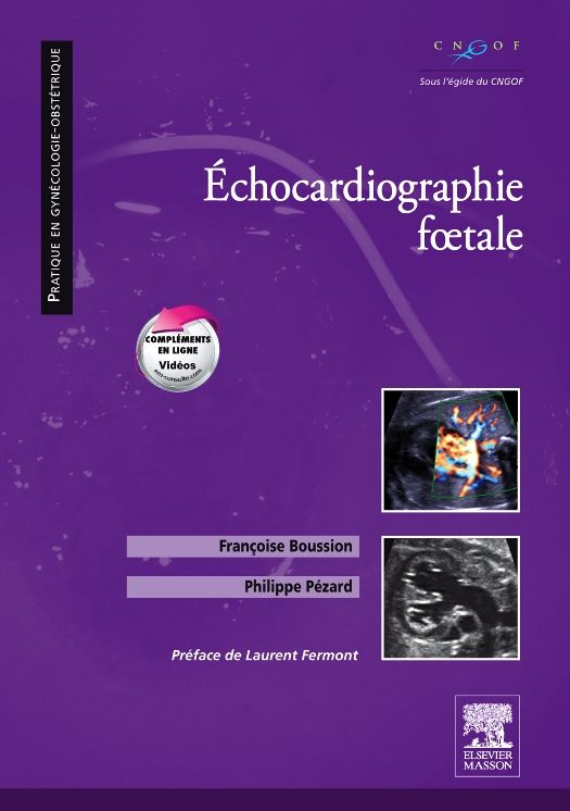 Echocardiographie foetale