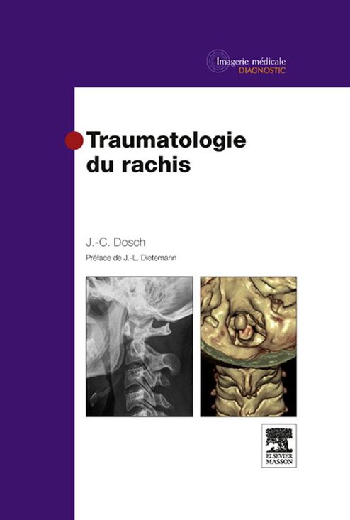 Traumatologie du rachis