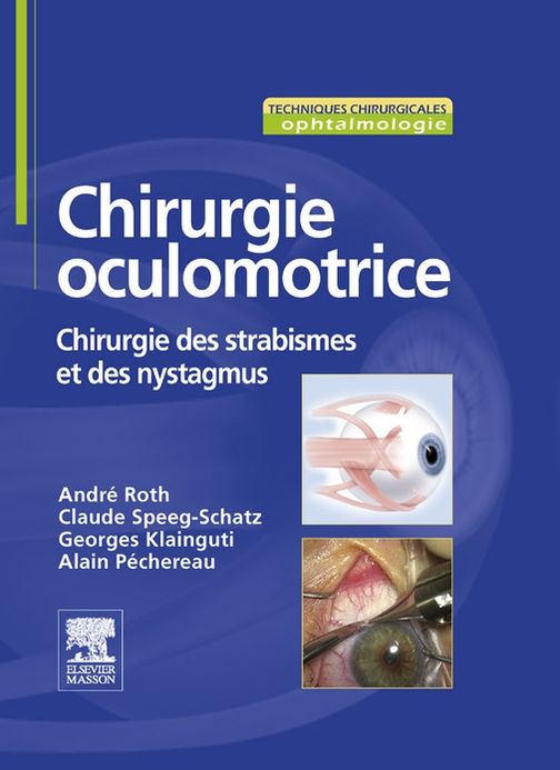 Chirurgie oculomotrice: Chirurgie du strabisme et des nystagmus