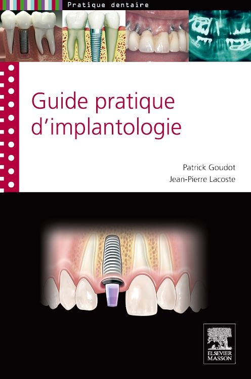guide pratique d'implantologie