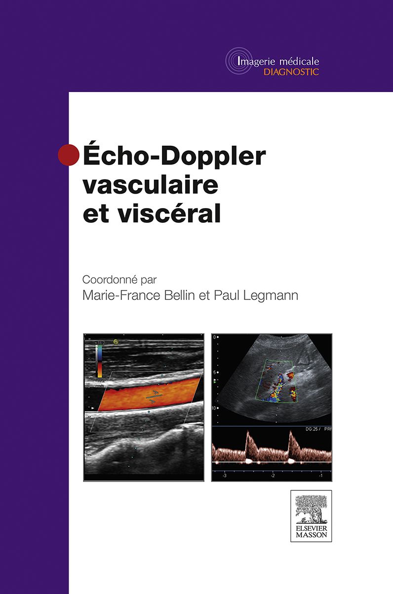 Echo-Doppler vasculaire et viscéral