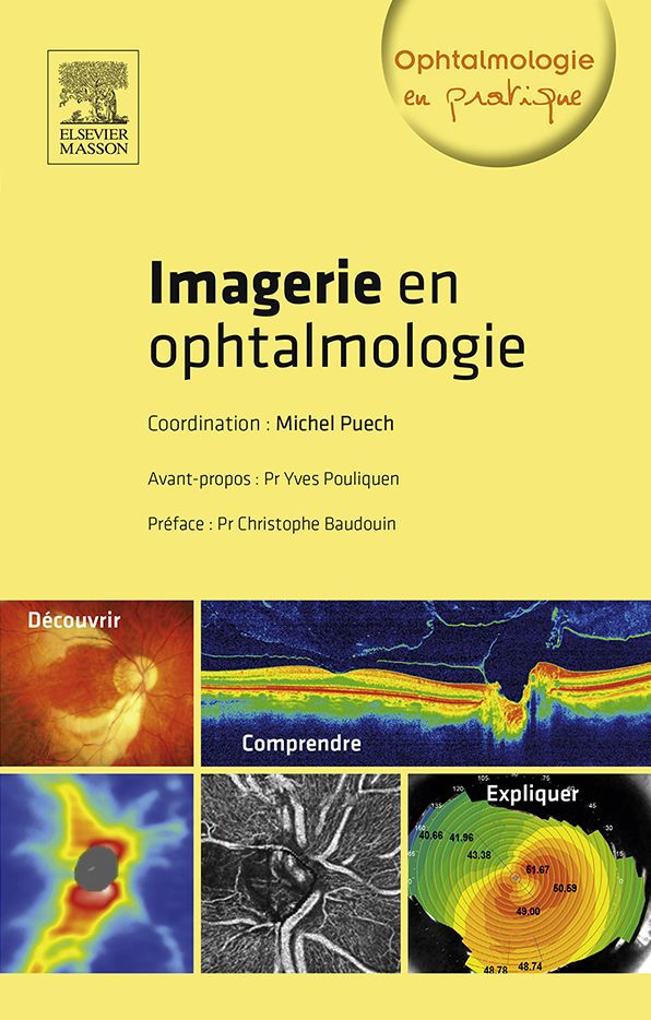 Imagerie en ophtalmologie