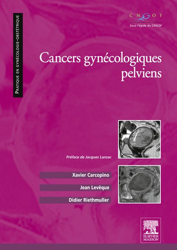 Cancers gynécologiques pelviens