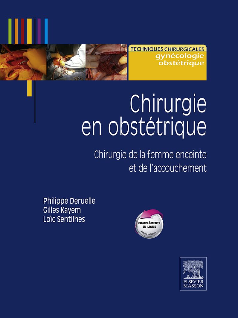 Chirurgie en obstétrique: Chirurgie de la femme enceinte et de l'accouchement
