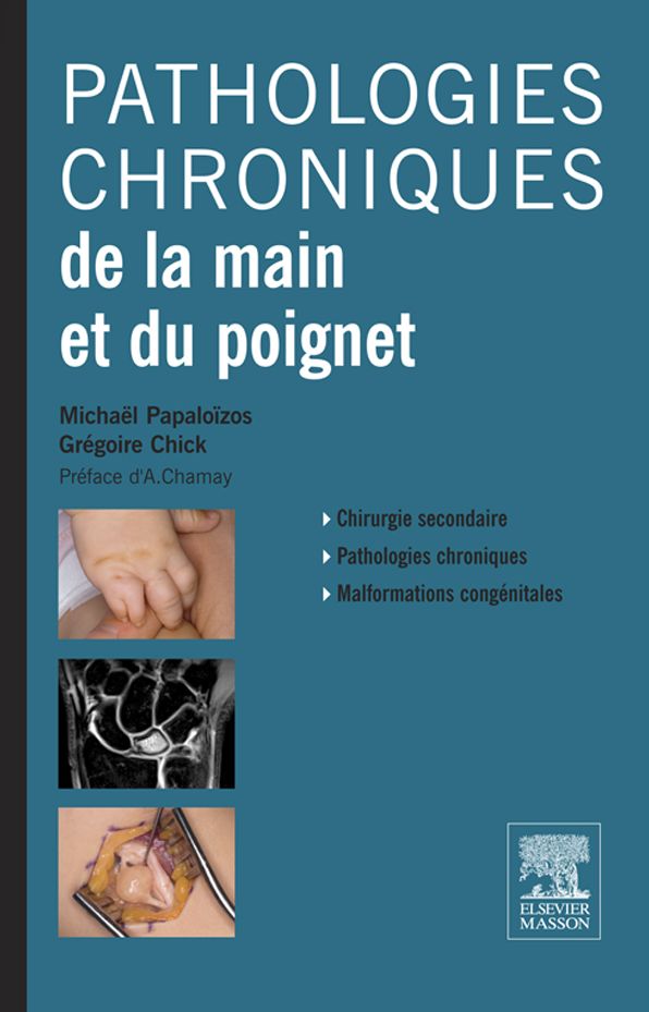 Pathologies chroniques de la main et du poignet
