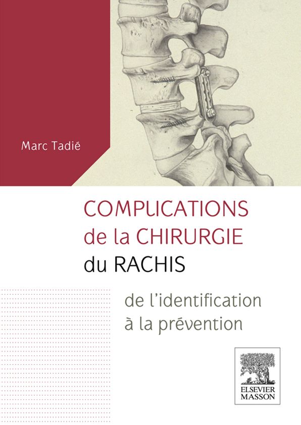 Complications de la chirurgie du rachis: de l'identification à la prévention