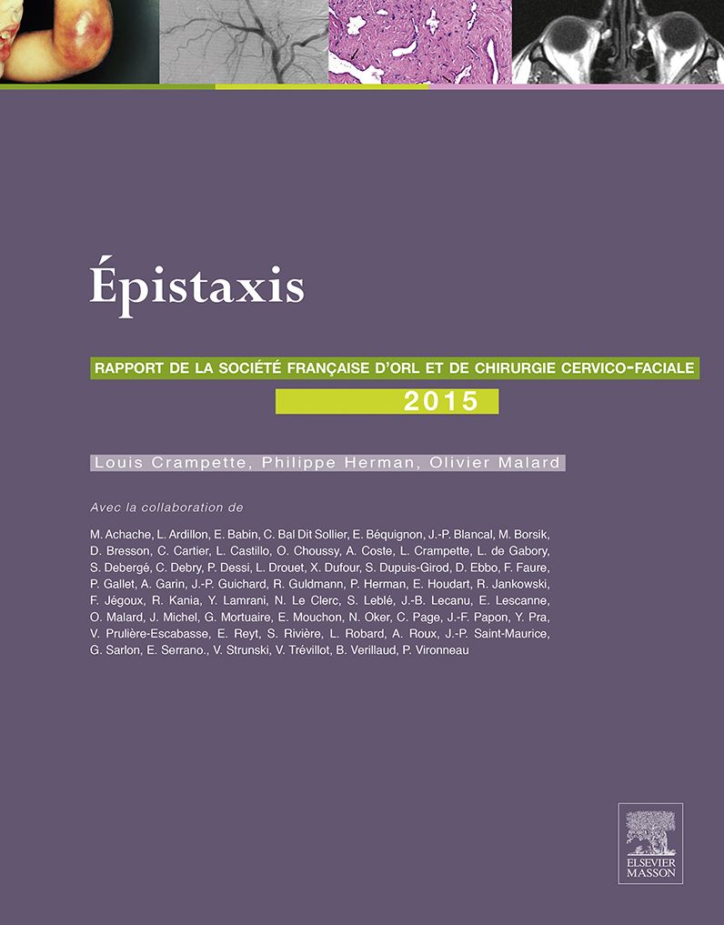 Les épistaxis: Rapport SFORL 2015