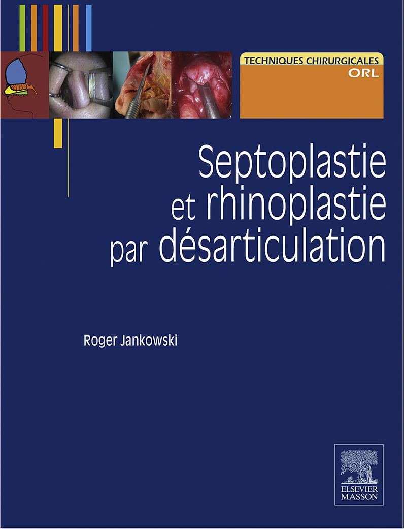 Septoplastie et rhinoplastie par désarticulation: Histoire, anatomie, chirurgie et architecture naturelles du nez