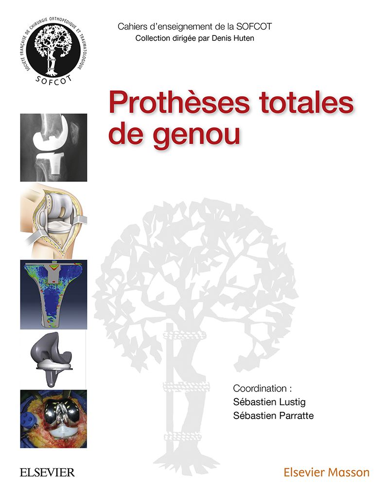 Prothèses totales de genou