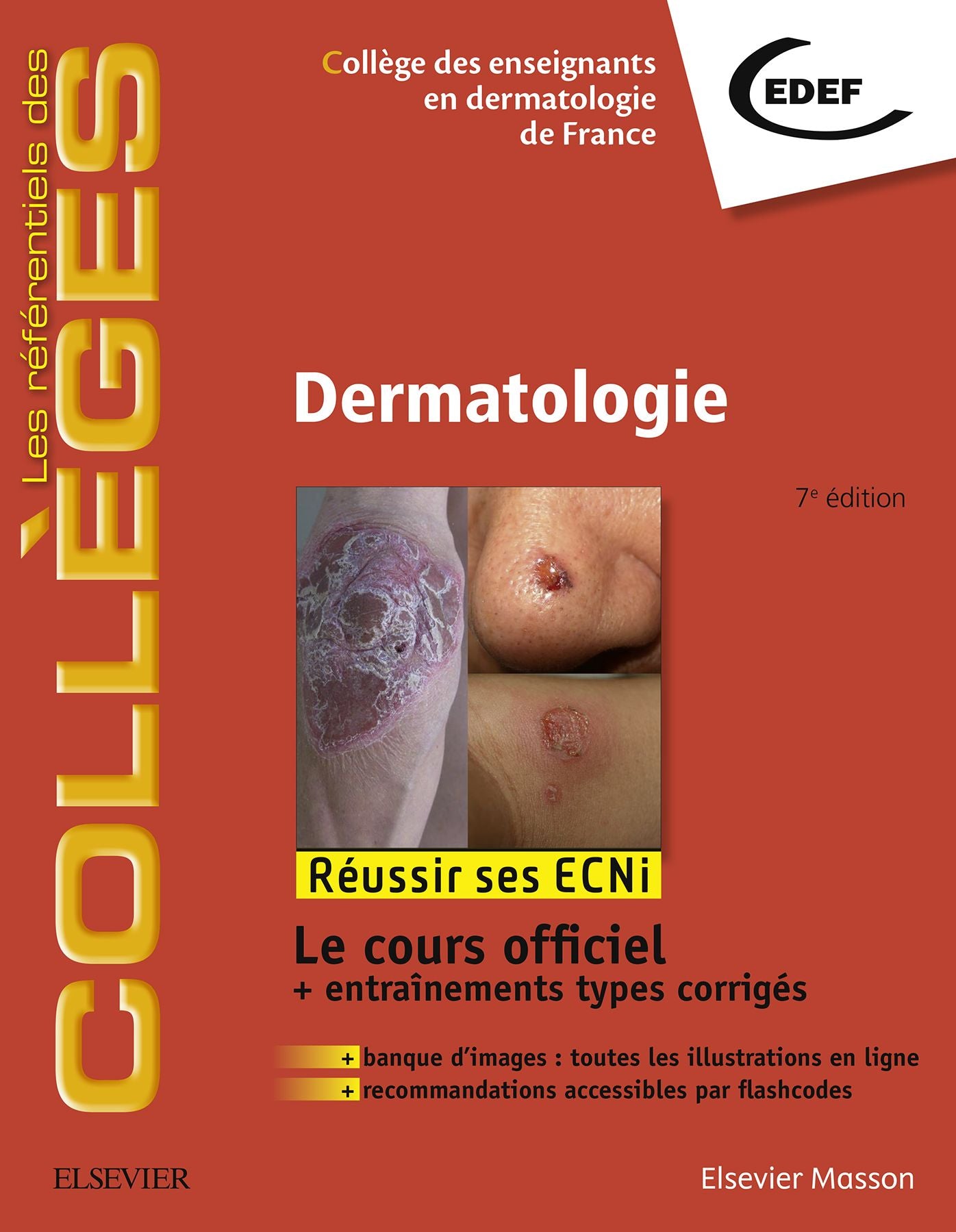 Dermatologie: Réussir les ECNi