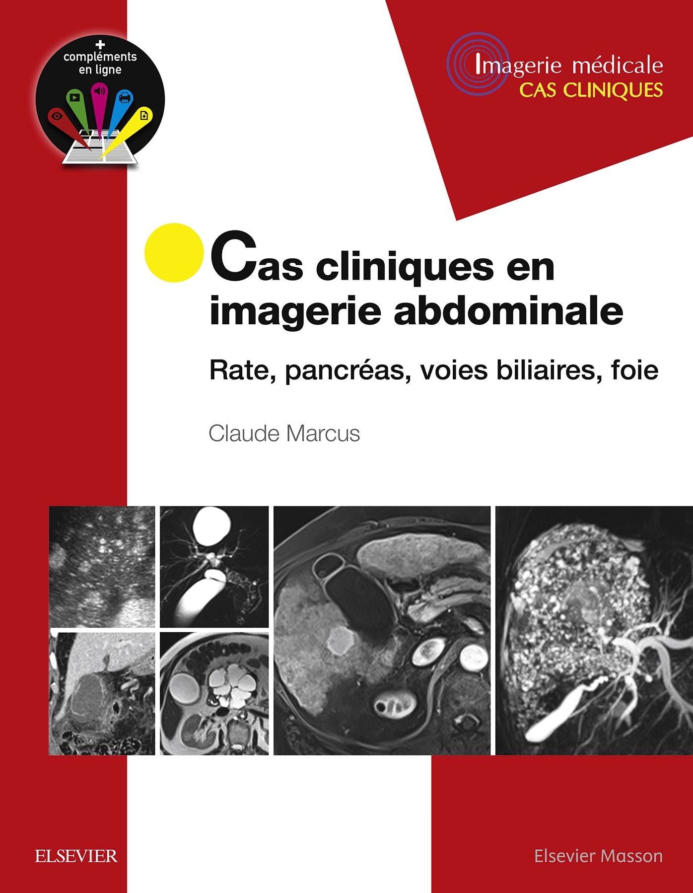 Cas cliniques en imagerie abdominale: Rate, pancréas, voies biliaires, foie