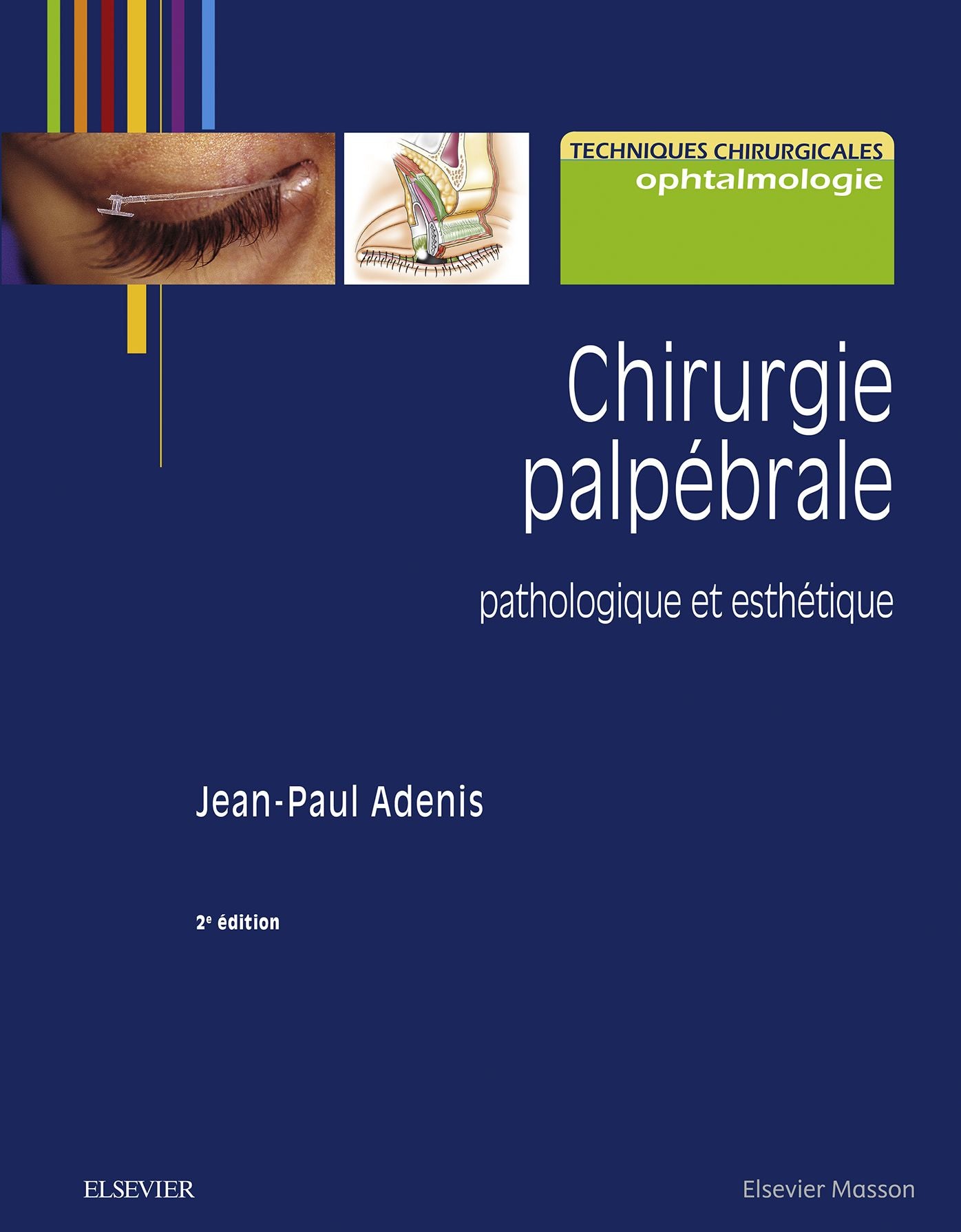 Chirurgie palpébrale: pathologique et esthétique
