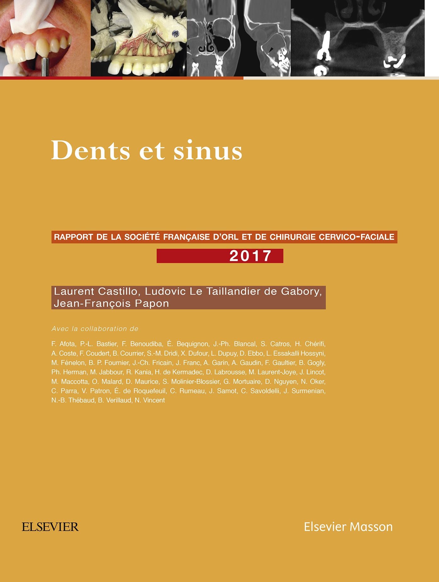 Dents et sinus: Rapport SFORL 2017