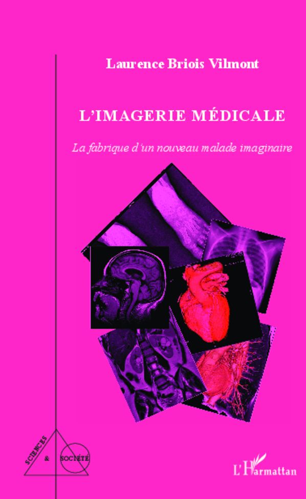 L'imagerie médicale: La fabrique d'un nouveau malade imaginaire