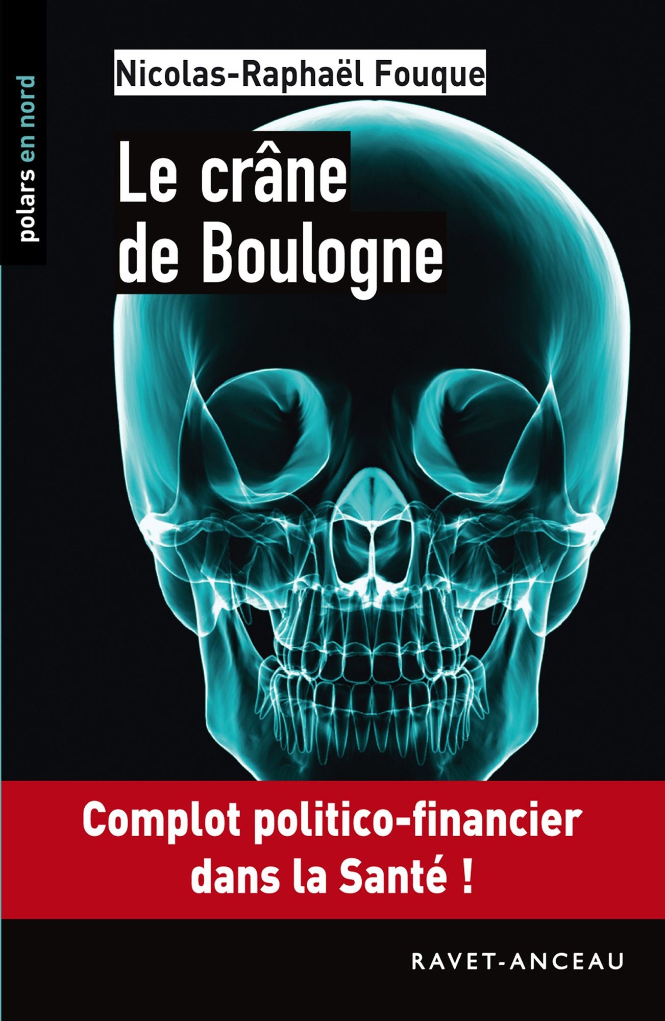 Le crâne de Boulogne: Complot politico-financier dans la Santé !