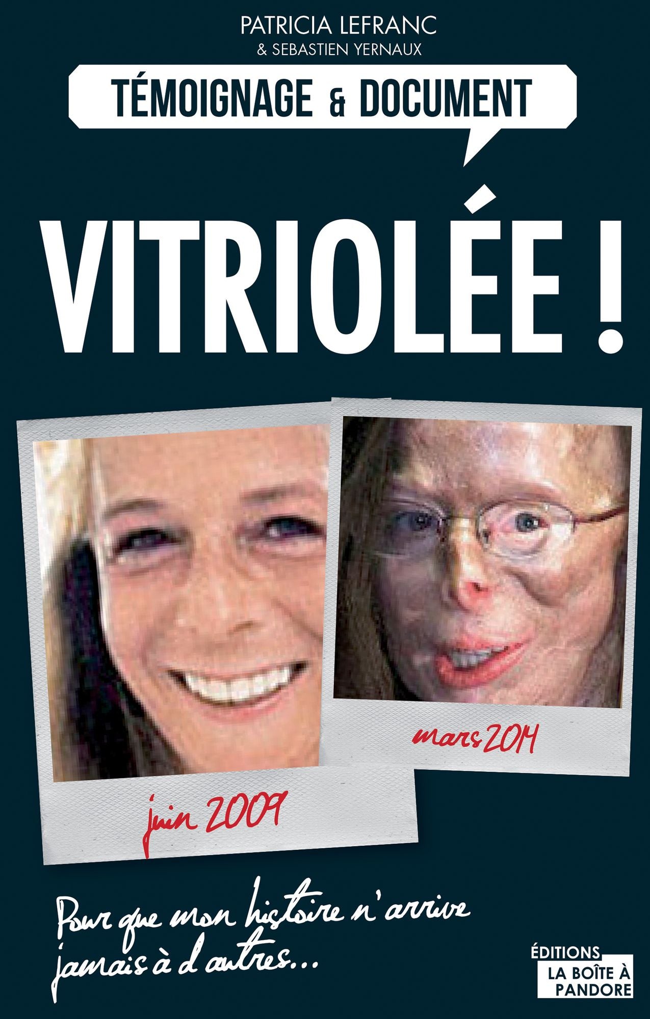 Vitriolée !: Brûlée à l'acide, une victime raconte son enfer
