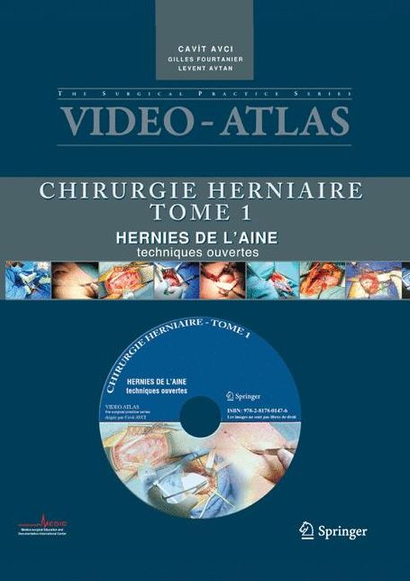 Vidéo atlas Chirurgie herniaire: I. Hernie de l'aine, techniques ouvertes