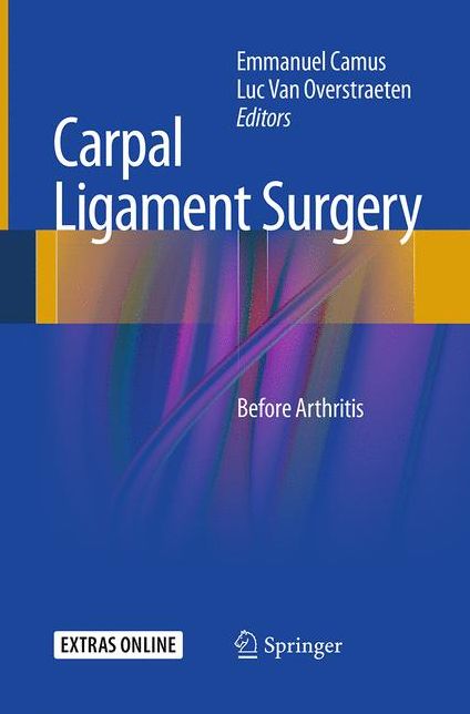 Carpal Ligament Surgery: Before Arthritis