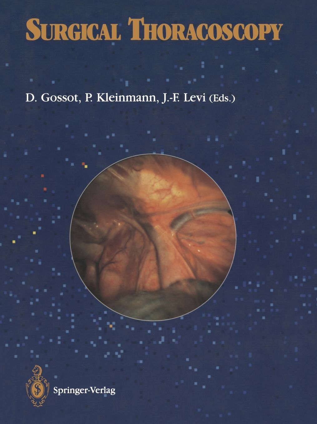 Surgical thoracoscopy