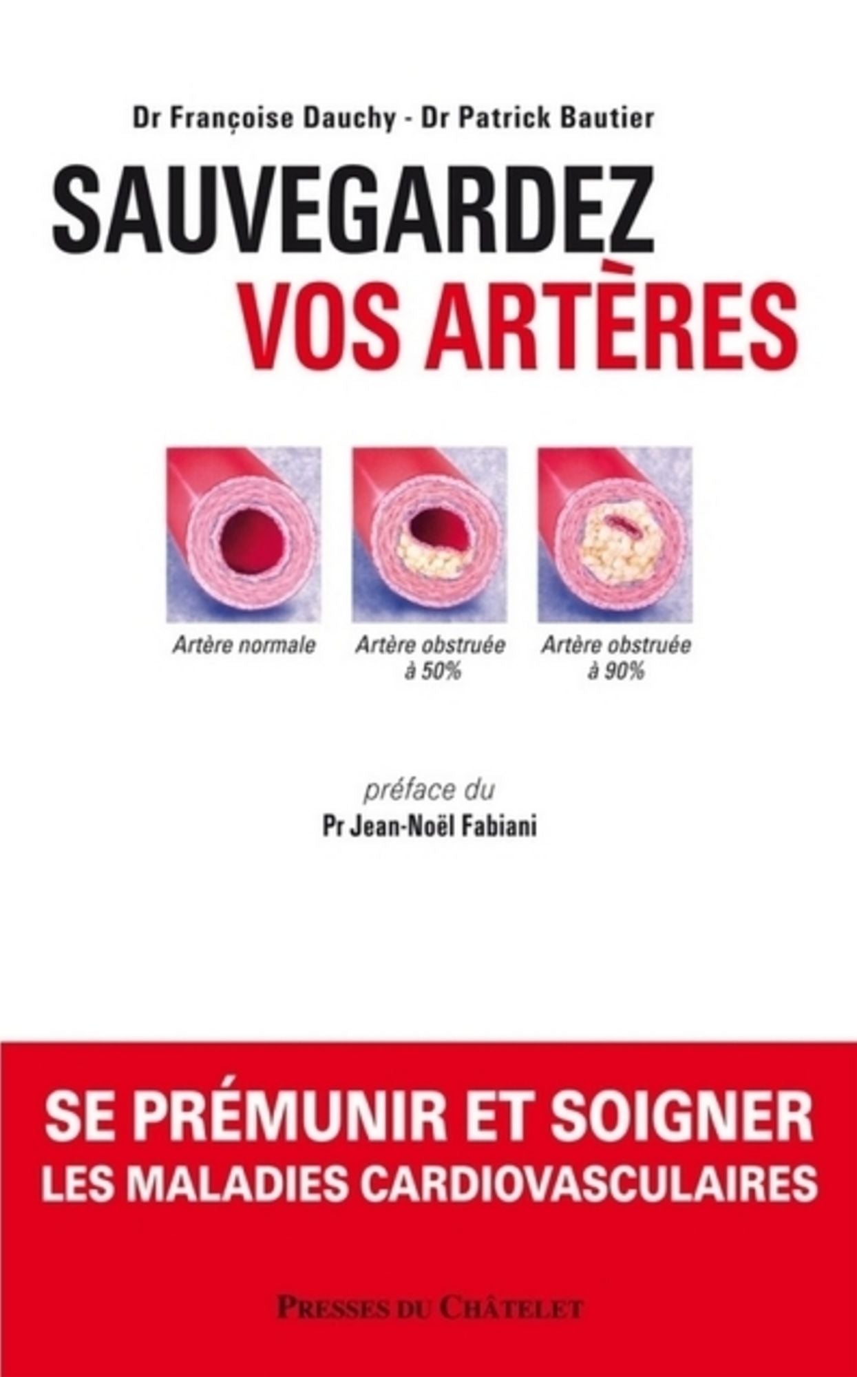 Sauvegardez vos artères