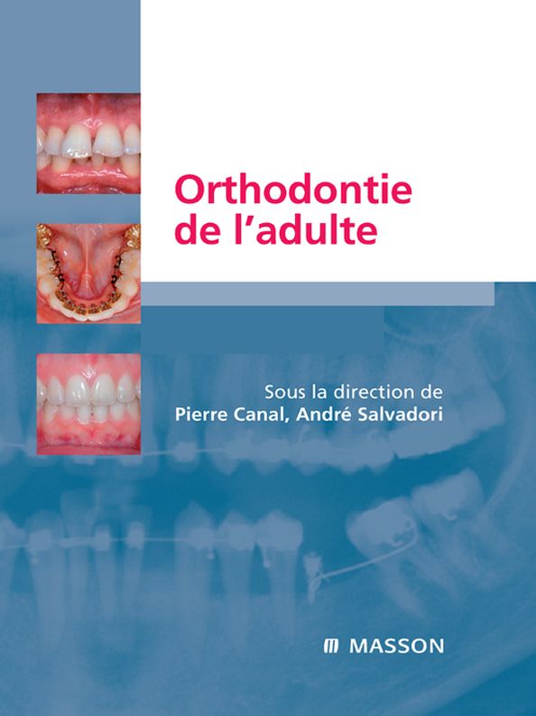 Orthodontie de l'adulte: Rôle de l'orthodontie dans la réhabilitation générale de l'adulte