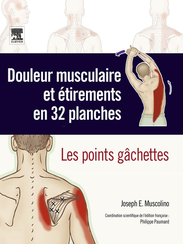 Douleur musculaire et étirements en 32 planches: Les points gâchettes