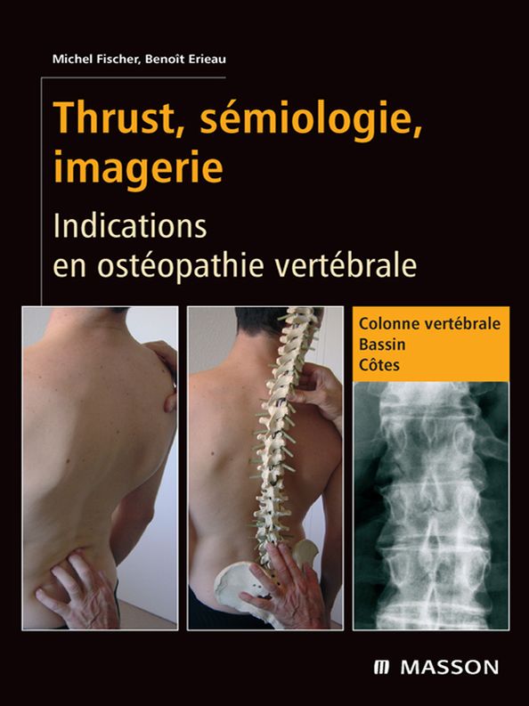 Thrust, sémiologie, imagerie: Indications en ostéopathie vertébrale
