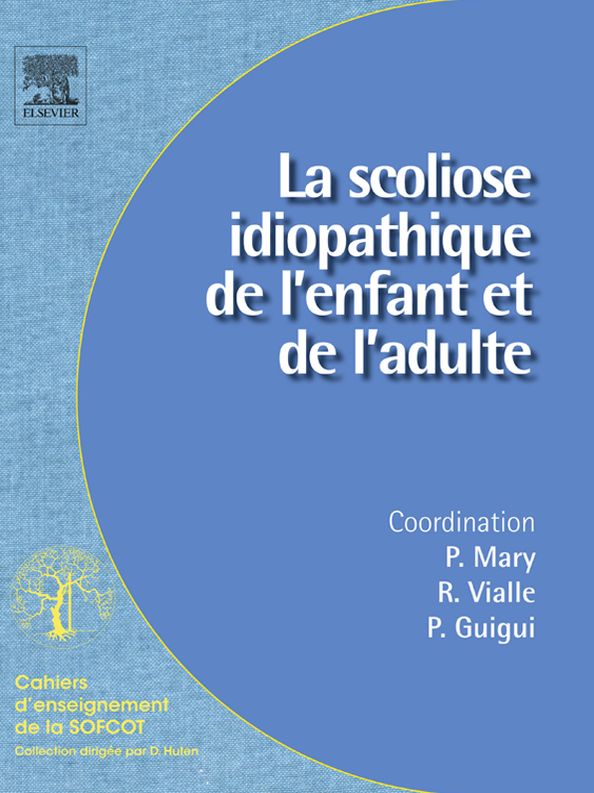 La scoliose idiopathique de l'enfant et de l'adulte