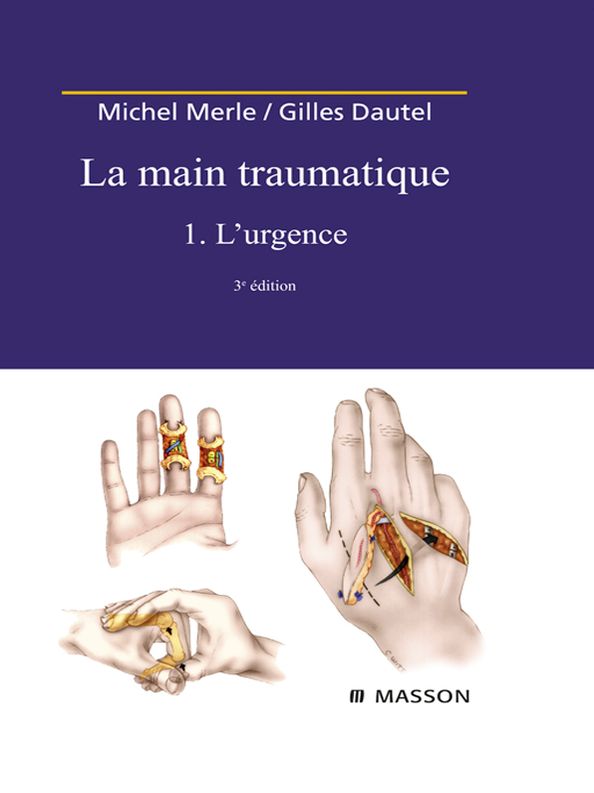 La Main traumatique. Tome 1. L'Urgence
