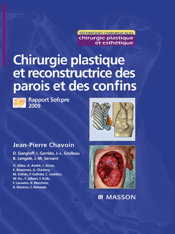 Chirurgie plastique et reconstructrice des parois et des confins: Rapport Sofcpre 2009