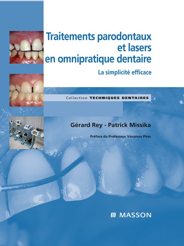 Traitements parodontaux et lasers en omnipratique dentaire: La simplicité efficace