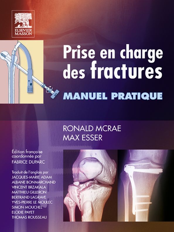 Prise en charge des fractures: Manuel pratique