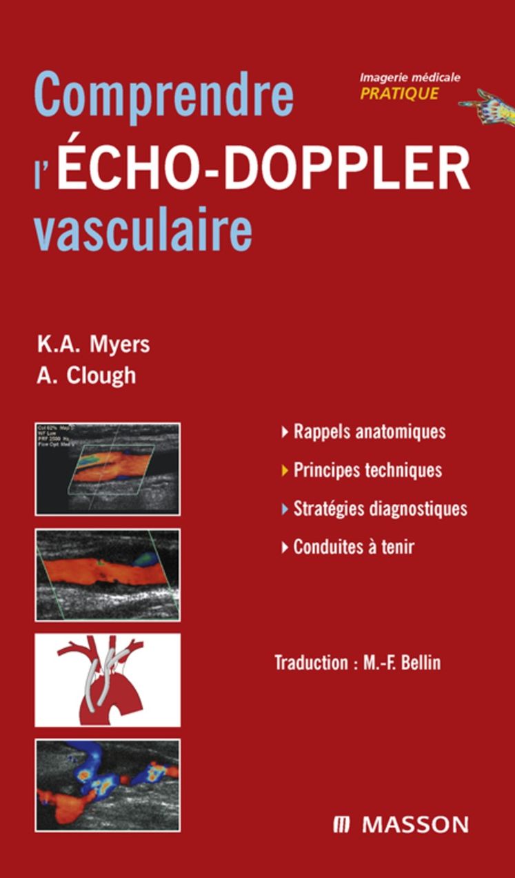 Comprendre l'Echo-Doppler vasculaire