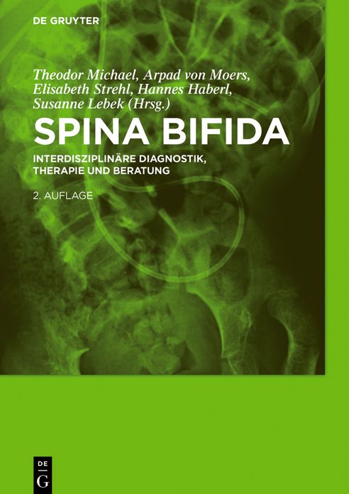 Spina bifida: Interdisziplinare Diagnostik, Therapie und Beratung