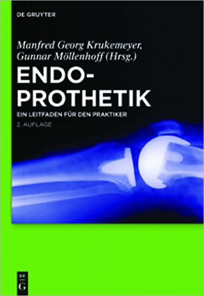 Endoprothetik: Ein Leitfaden fur den Praktiker