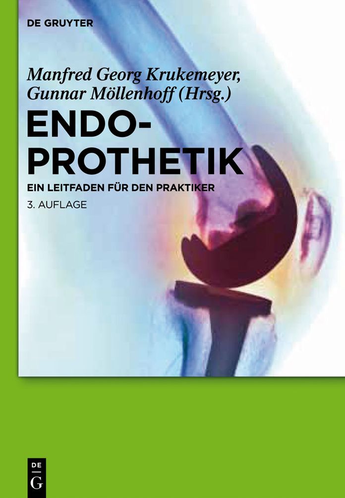 Endoprothetik: Ein Leitfaden fur den Praktiker