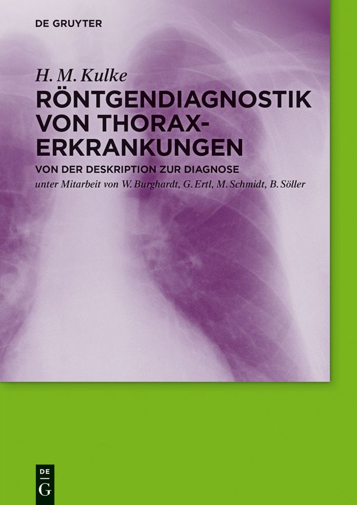 Rontgendiagnostik von Thoraxerkrankungen: Von der Deskription zur Diagnose